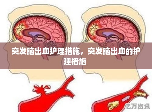 突發(fā)腦出血護(hù)理措施，突發(fā)腦出血的護(hù)理措施 