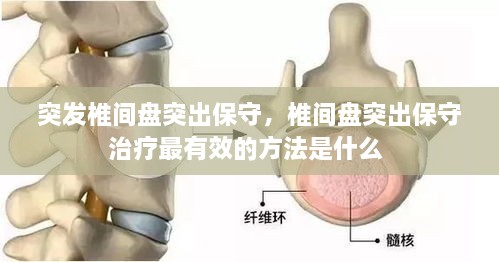 突發(fā)椎間盤(pán)突出保守，椎間盤(pán)突出保守治療最有效的方法是什么 